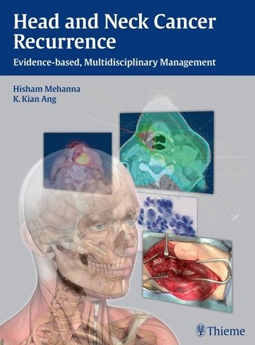 Head and Neck Cancer Recurrence – Evidence–based, Multidisciplinary Management