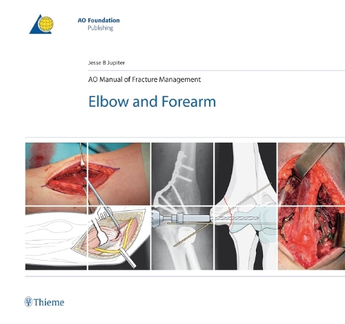 AO Manual of Fracture Management – Elbow & Forearm Jupiter Hardback