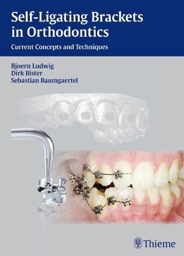 Self–Ligating Brackets in Orthodontics – Current Concepts and Techniques Ludwig
