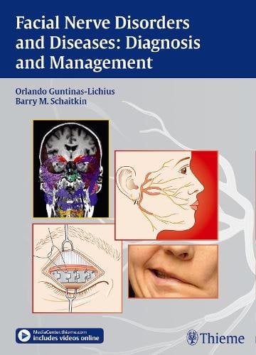 Facial Nerve Disorders and Diseases: Diagnosis and Management Guntinas–lichiu