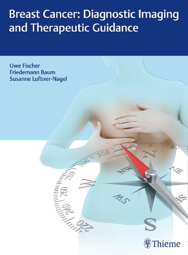 Breast Cancer: Diagnostic Imaging and Therapeutic Guidance Fischer Baum Hardback