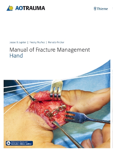 Manual of Fracture Management – Hand Jupiter Nunez Fricker Hardback MM – Thieme