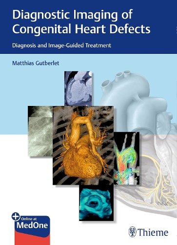 Diagnostic Imaging of Congenital Heart Defects – Diagnosis and Image–Guided Tre…