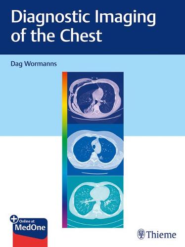Diagnostic Imaging of the Chest Wormanns Paperback John Wiley & Sons