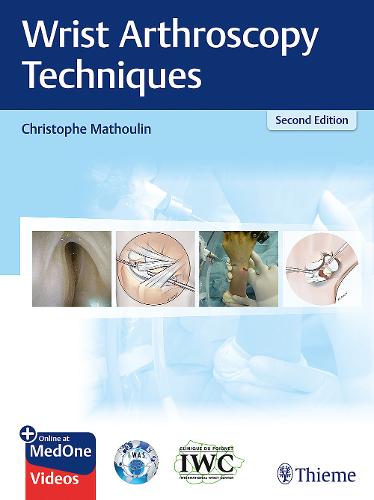 Wrist Arthroscopy Techniques Thieme Paperback John Wiley & Sons 9783132429109