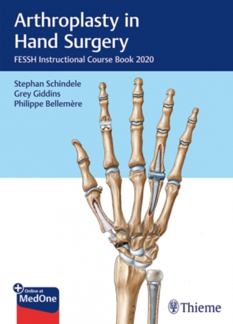 Arthroplasty in Hand Surgery – FESSH Instructional Course Book 2020 Schindele