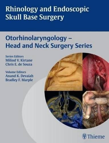 Rhinology and Endoscopic Skull Base Surgery Devaiah Marple Hardback